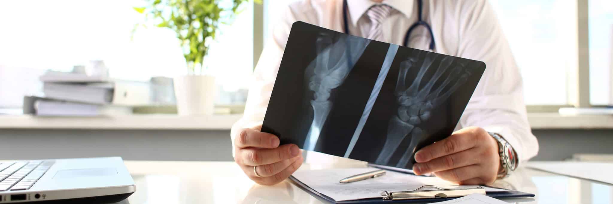 Spain using bone biometrics to determine migrants' ages - Vimarsana News